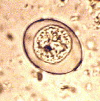 Кокцидия под микроскопом
